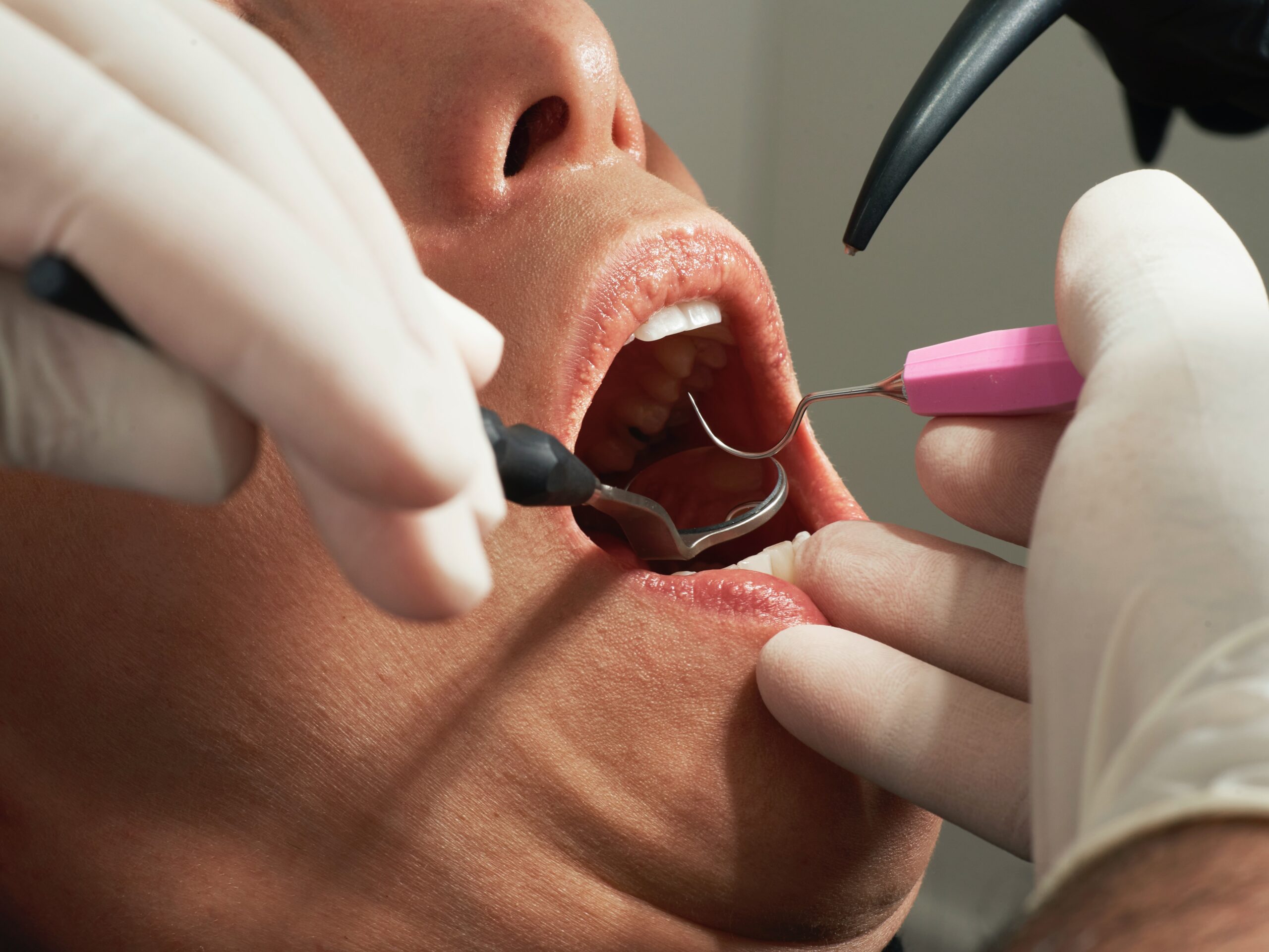The 12 Most Common Dental Services That Everyone Should be Aware Of